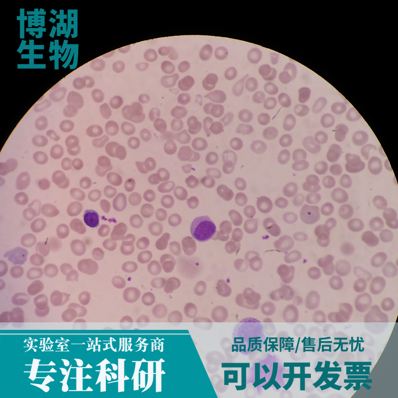 KM12人结肠癌细胞