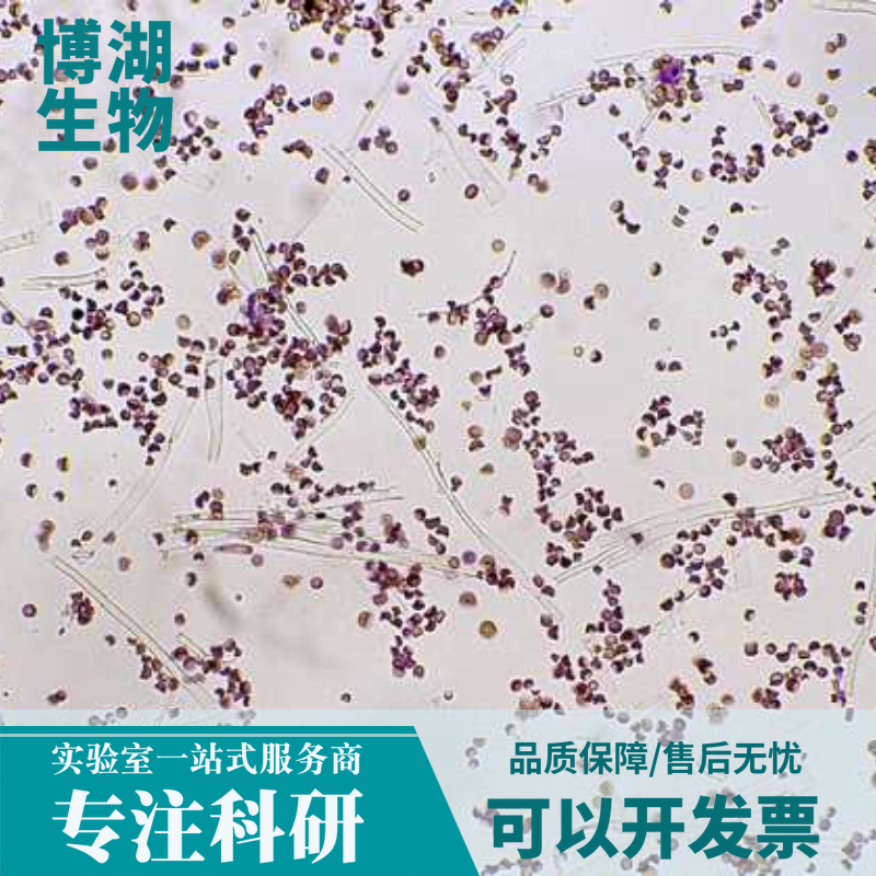 KM12人结肠癌细胞