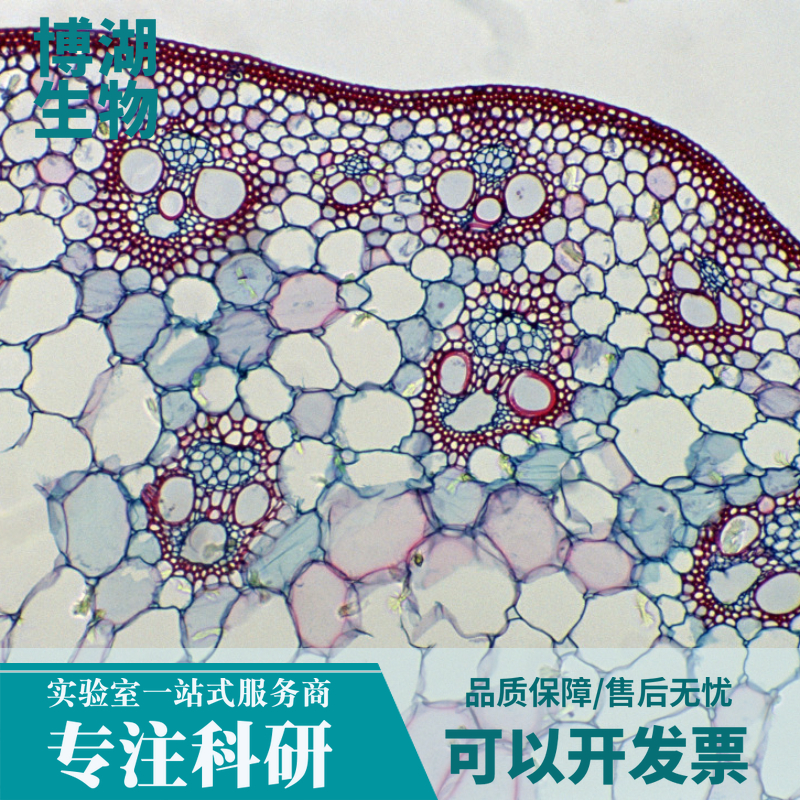 KM12人结肠癌细胞