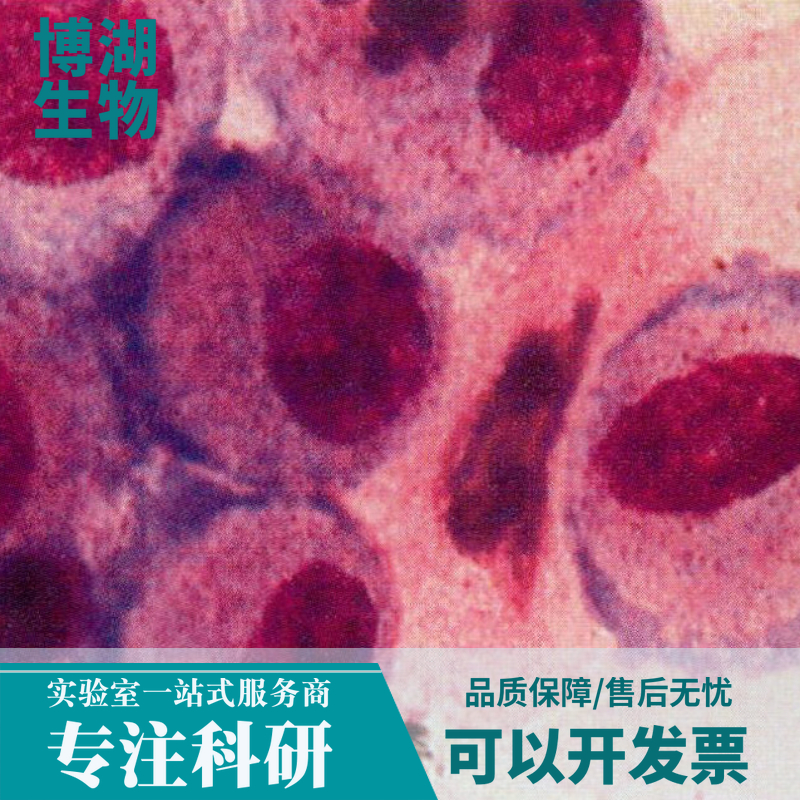 KM12人结肠癌细胞