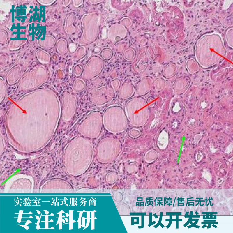 HuNS1人多发性骨髓瘤细胞