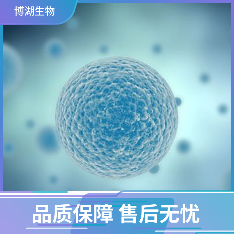 HuNS1人多发性骨髓瘤细胞