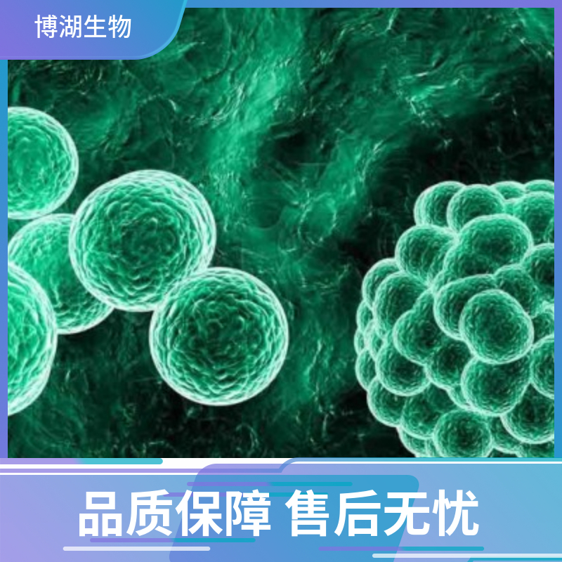 HuNS1人多发性骨髓瘤细胞