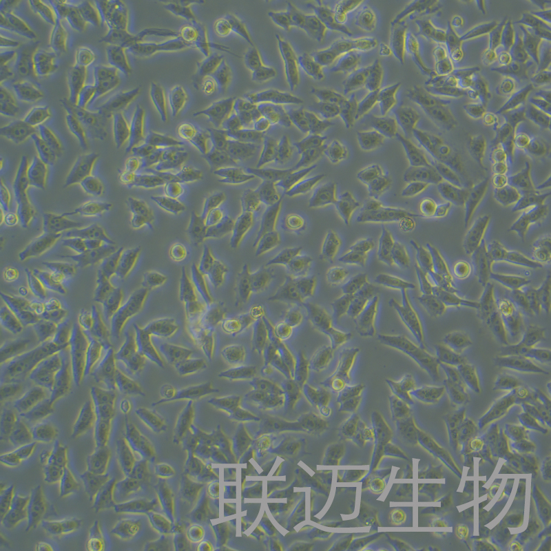 HGC-27细胞（人胃癌细胞未分化STR鉴定正确）LM8C0107