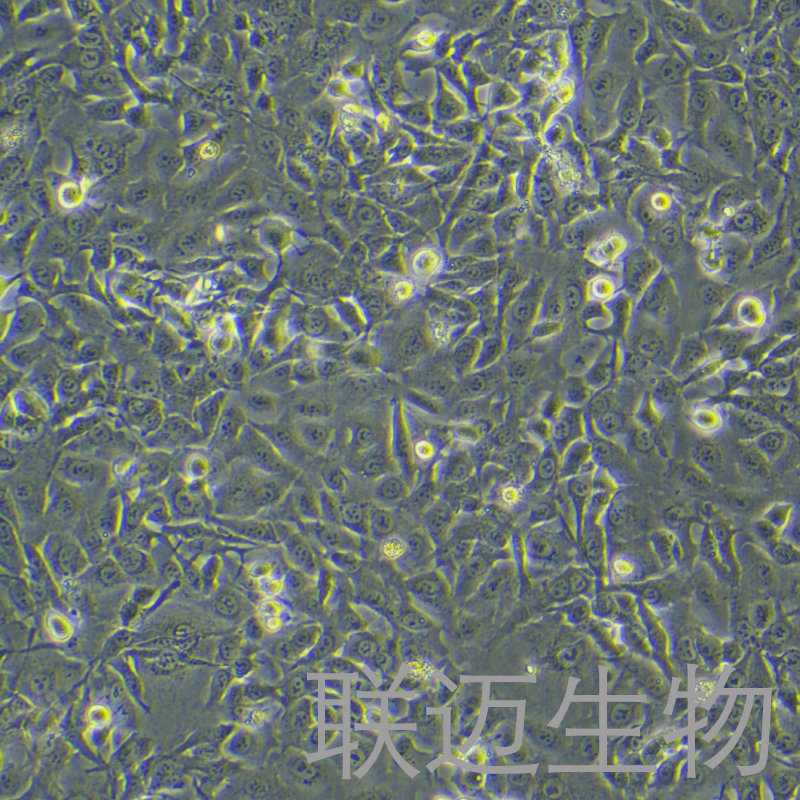 HCCC-9810细胞（人胆管细胞型肝癌细胞STR鉴定正确）LM8C0095