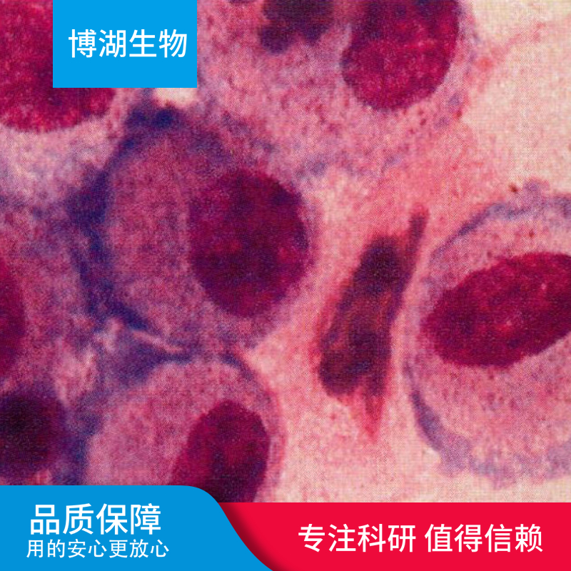 LC-1/sq-SF人非小细胞肺癌细胞