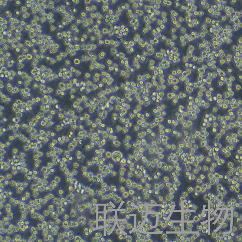 Raji细胞（Burkitt's淋巴瘤细胞STR鉴定正确）LM8C0189