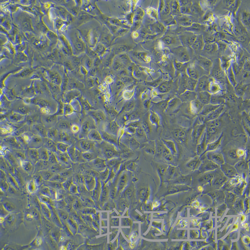 RBE细胞（肝胆管癌细胞STR鉴定正确）LM8C0191