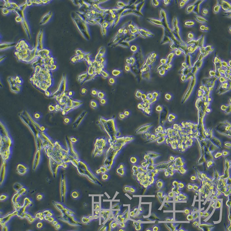 LLC[LL/2;LLC1]细胞（小鼠肺癌细胞种属鉴定正确）LM8C0140