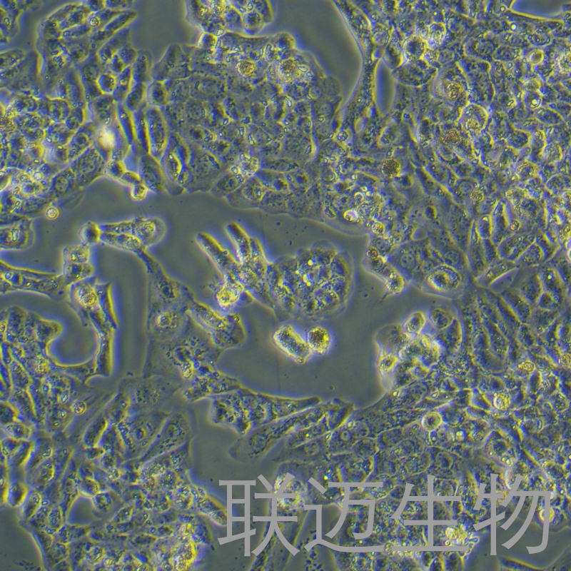 MLTC-1细胞（小鼠睾丸间质细胞瘤细胞种属鉴定正确）LM8C0159