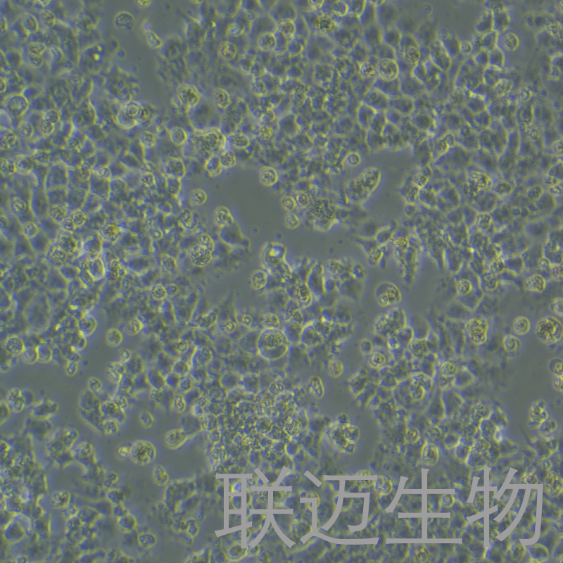 JAR细胞（人胎盘绒毛癌细胞STR鉴定正确）LM8C0126