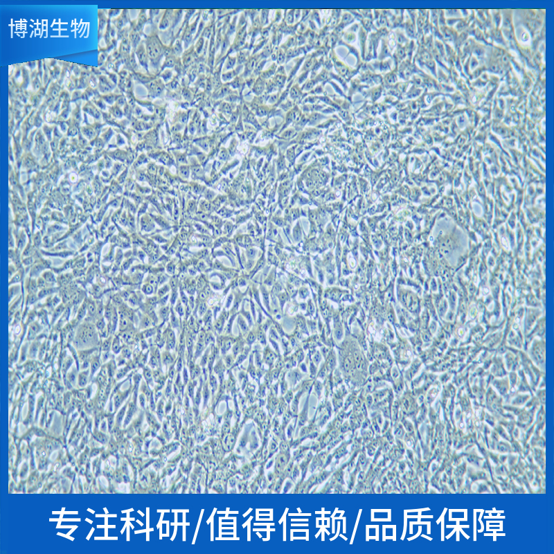 HEY人高级别浆液性卵巢癌细胞