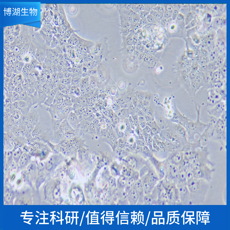 HT29 gluc C1白种人结肠腺癌细胞