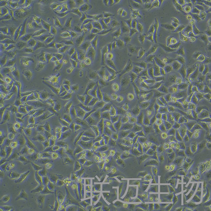 SMMC-7721细胞（肝癌细胞）LM8C0216