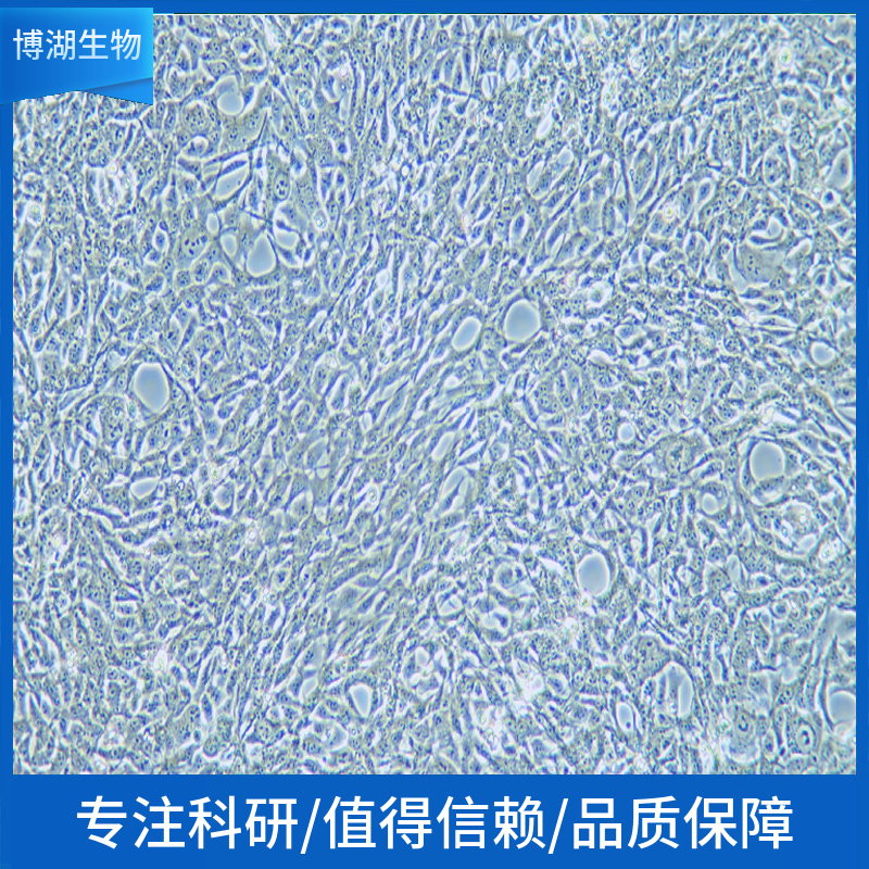 NCI-H510 {NCI-H510A, H510A] 人小细胞肺癌细胞