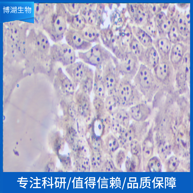 NCI-H510 {NCI-H510A, H510A] 人小细胞肺癌细胞
