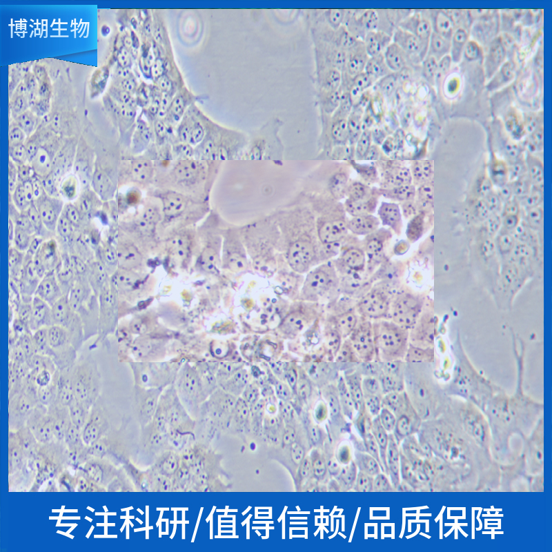 NCI-H460人非小细胞肺癌细胞