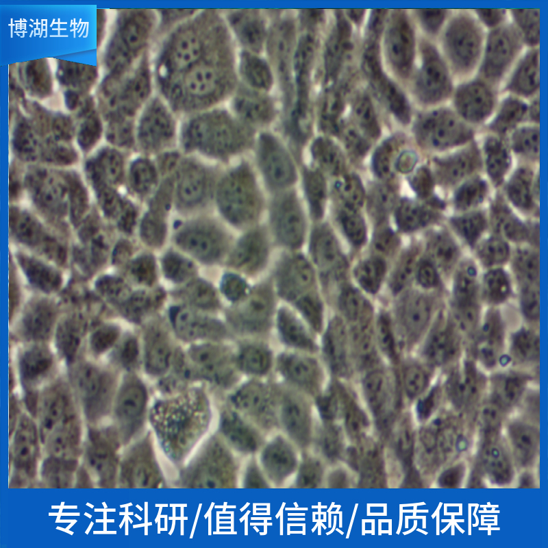 NCI-H441人非小细胞肺癌细胞