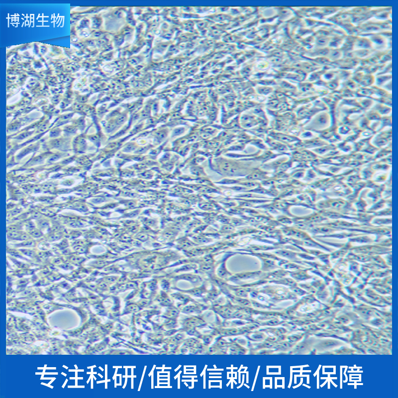 NCI-H1930人小细胞肺癌