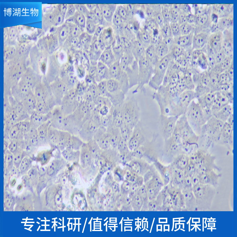 NCI-H1930人小细胞肺癌