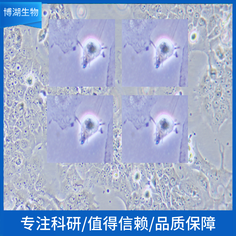 NCI-H1930人小细胞肺癌
