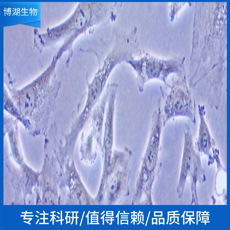 NCI-H345人小细胞肺癌细胞