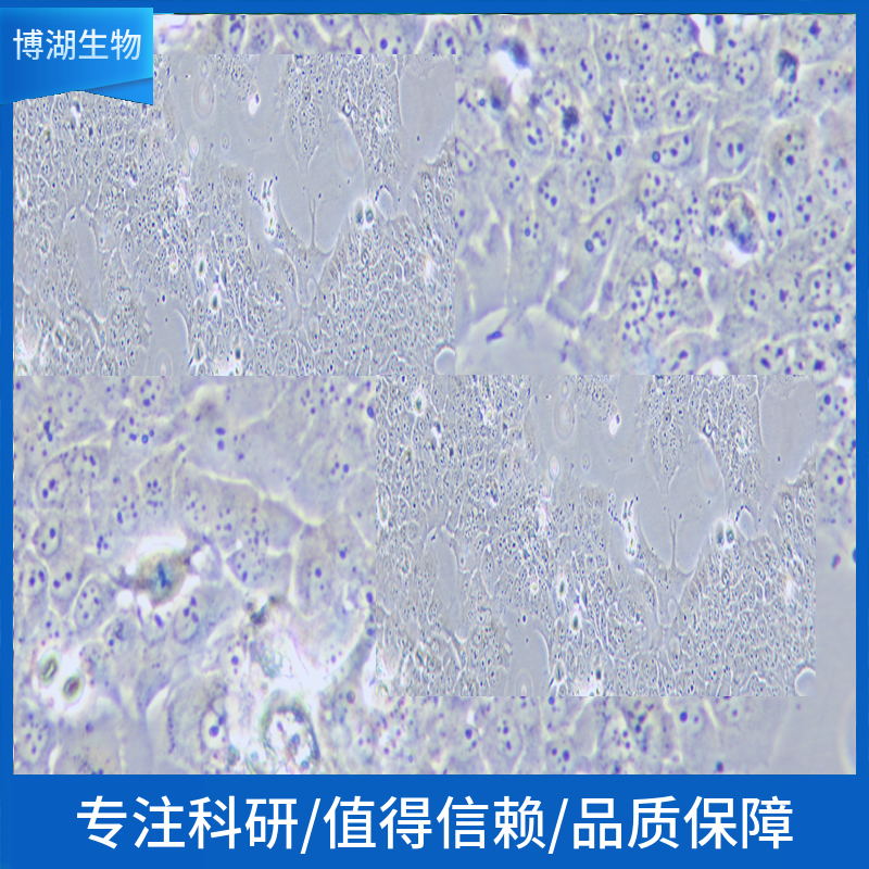 NCI-H2405人非小细胞肺癌细胞