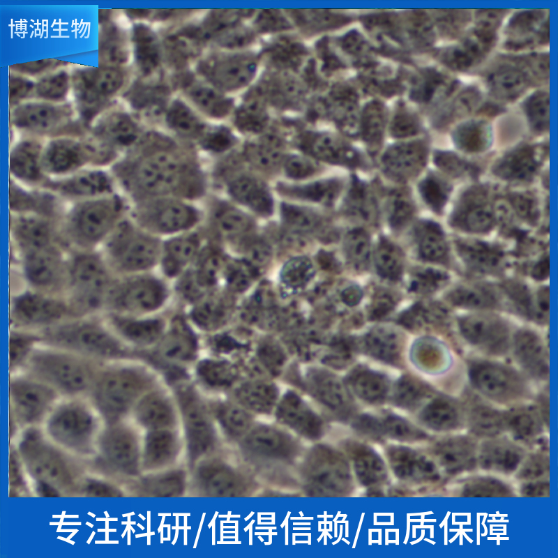 NCI-H2405人非小细胞肺癌细胞