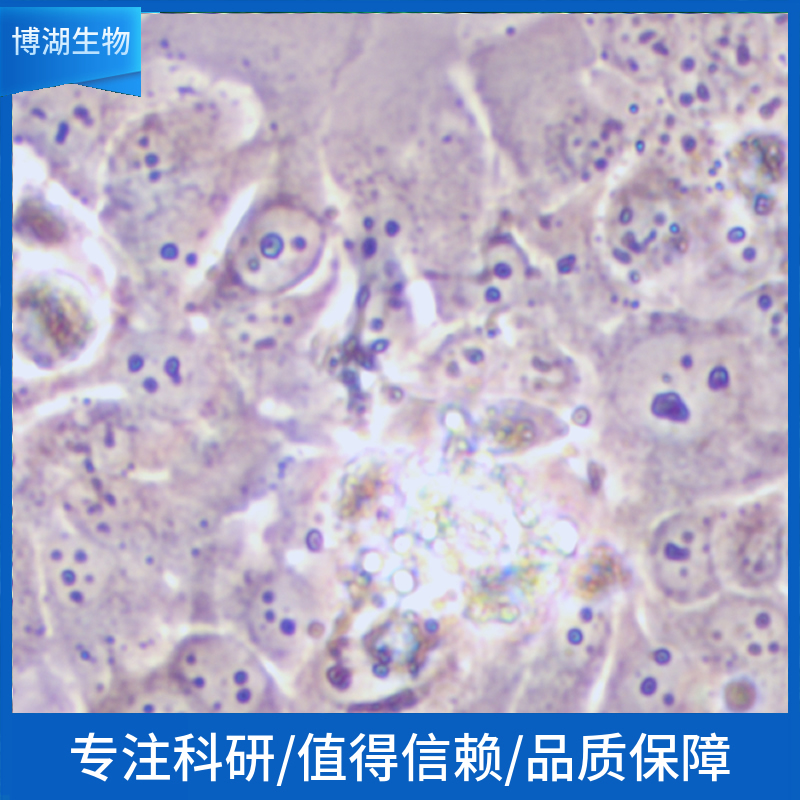 PA-1人卵巢畸胎瘤细胞