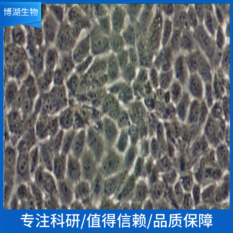 OVISE人卵巢癌细胞