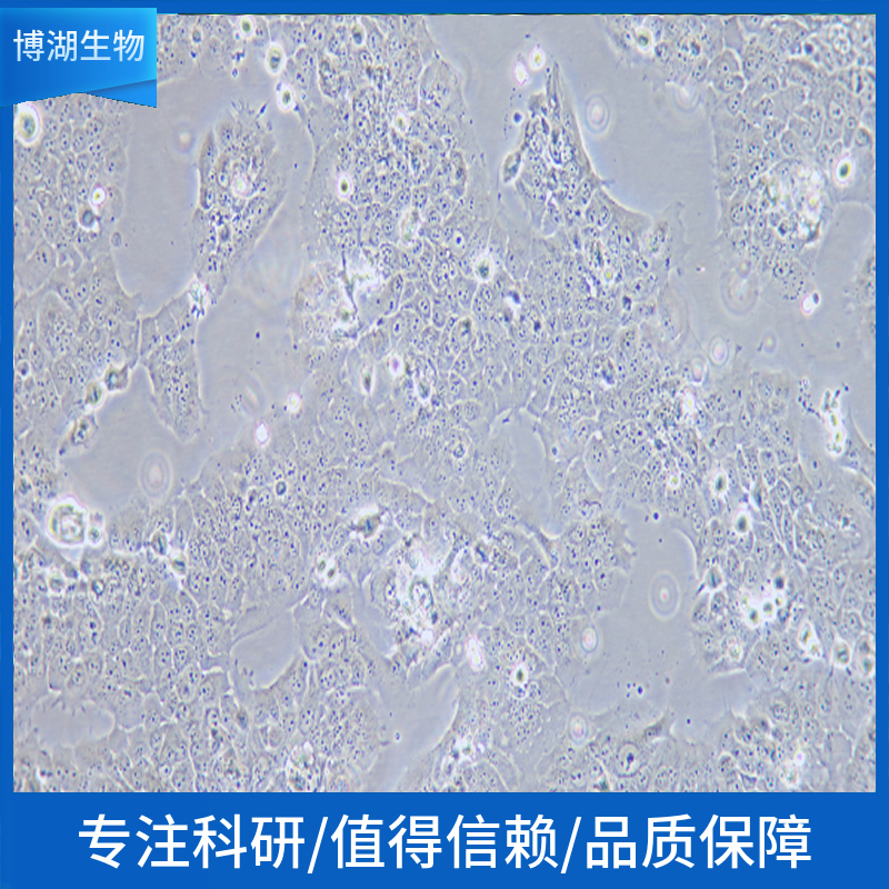 OVISE人卵巢癌细胞