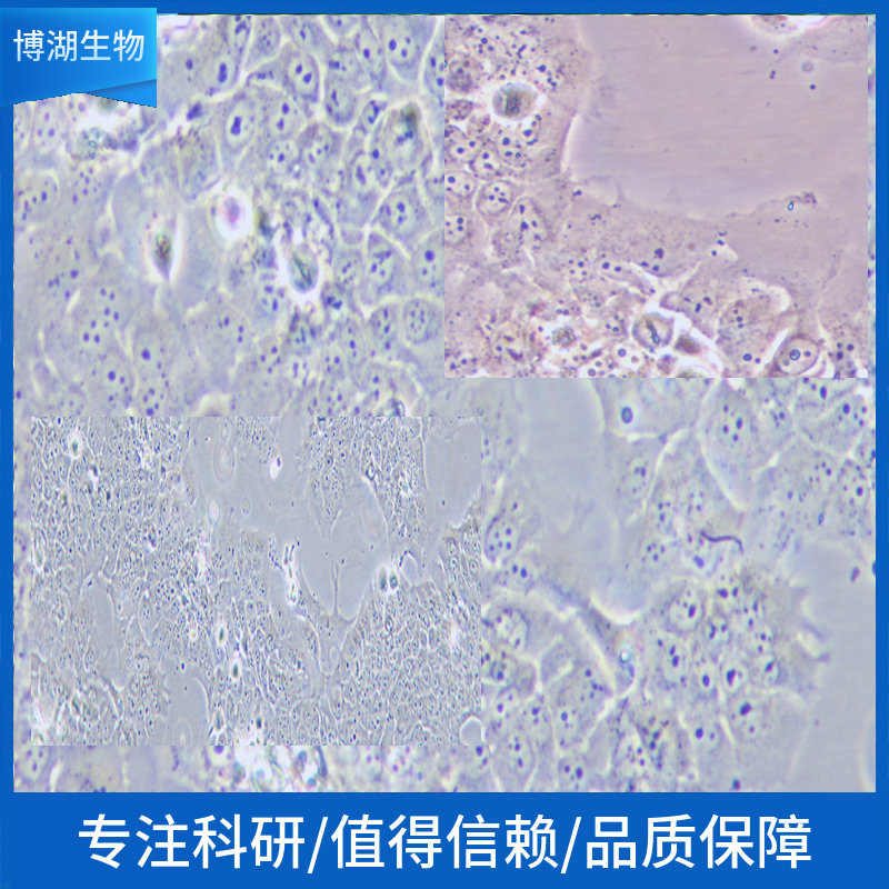 NCI-H2291人非小细胞肺癌细胞