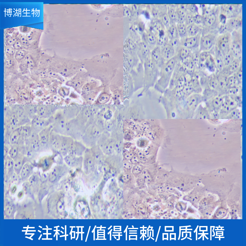 NCI-H820人非小细胞肺癌细胞