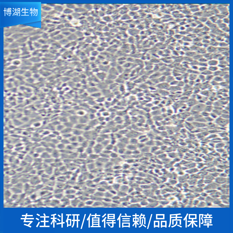 NM2C5人黑素瘤细胞