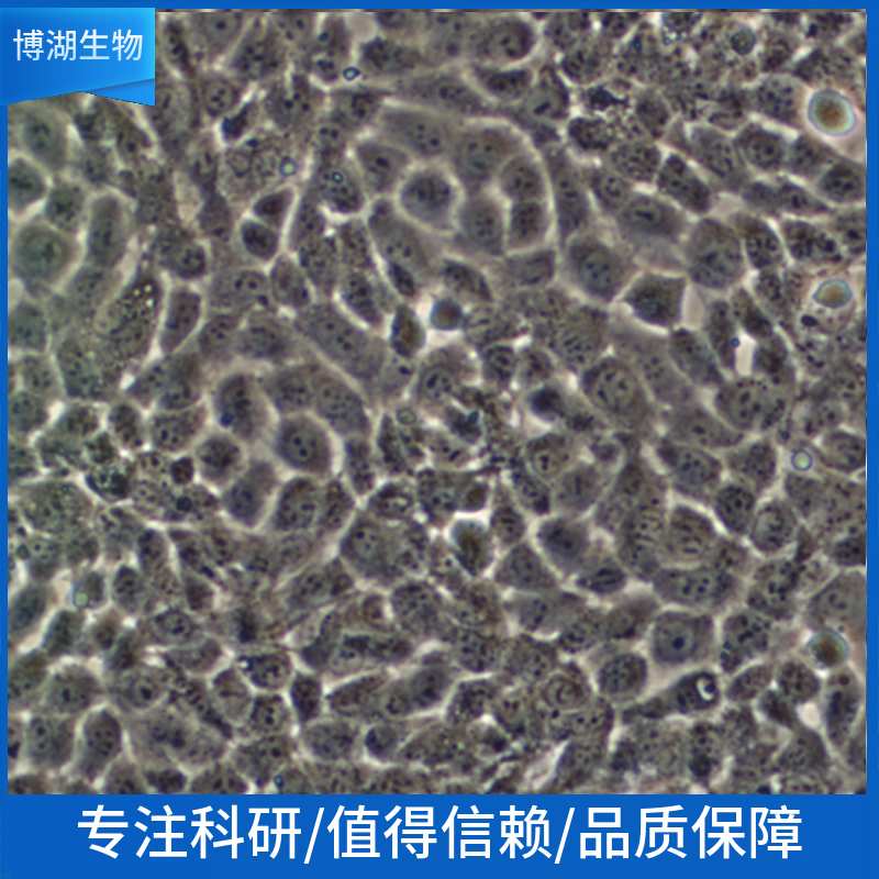 NCI-H1930人小细胞肺癌