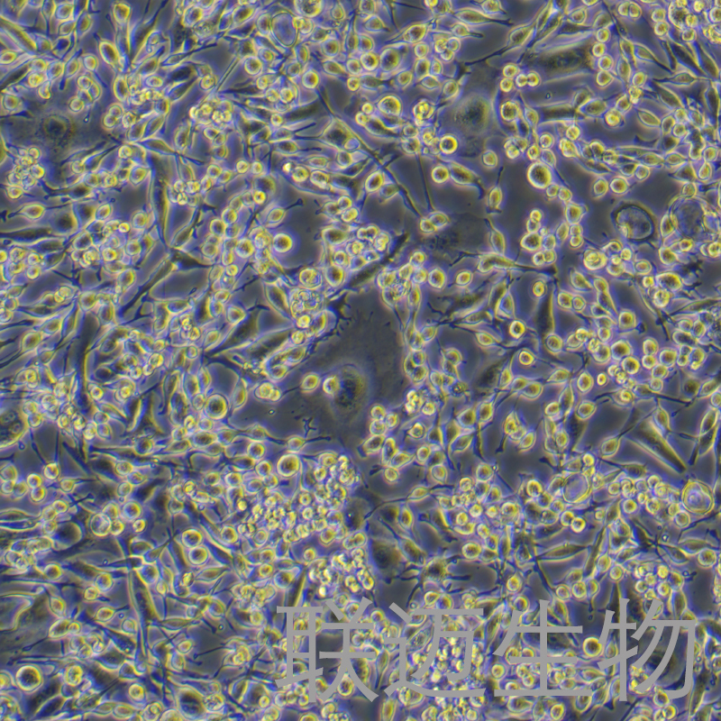 LA795细胞（小鼠肺腺癌细胞）LM8C0376