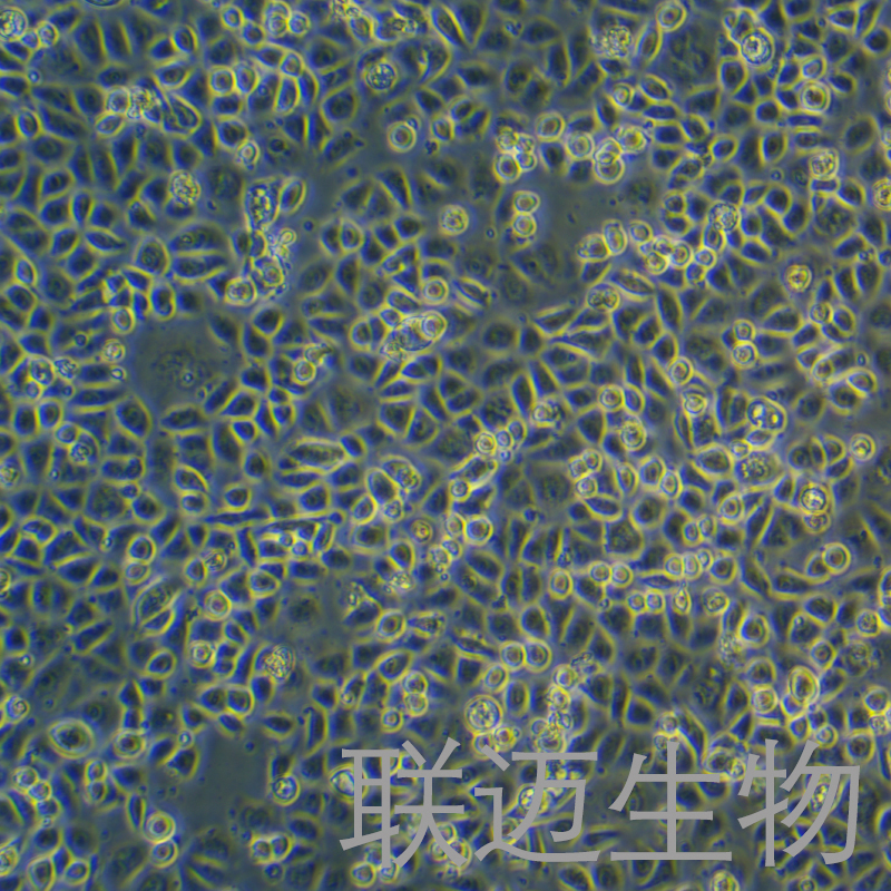 AGS细胞（胃腺癌细胞STR鉴定正确）LM8C0022