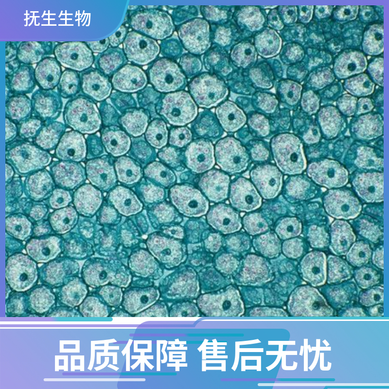 人肝癌细胞-荧光素酶标记;HepG2-LUC