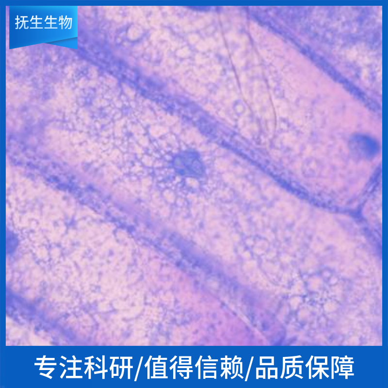 人主动脉平滑肌细胞；HASMC