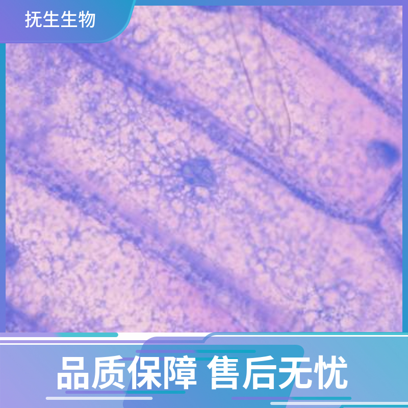 AN3 CA 人子宫内膜腺癌细胞