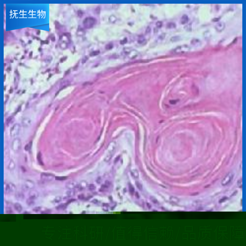 MHCC97-L人肝癌细胞