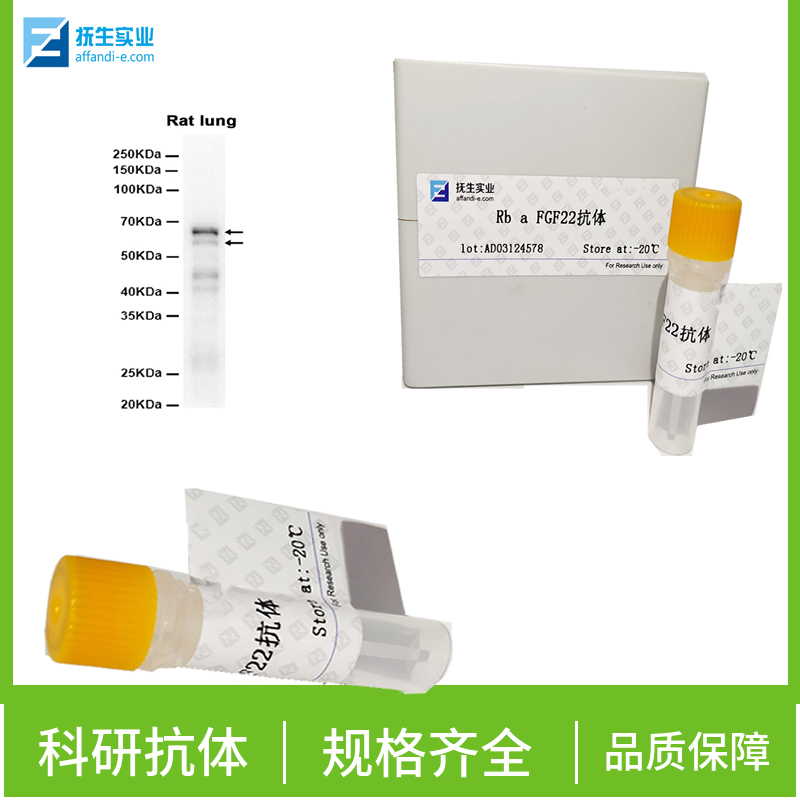 G蛋白偶联受体GPR91蛋白抗体