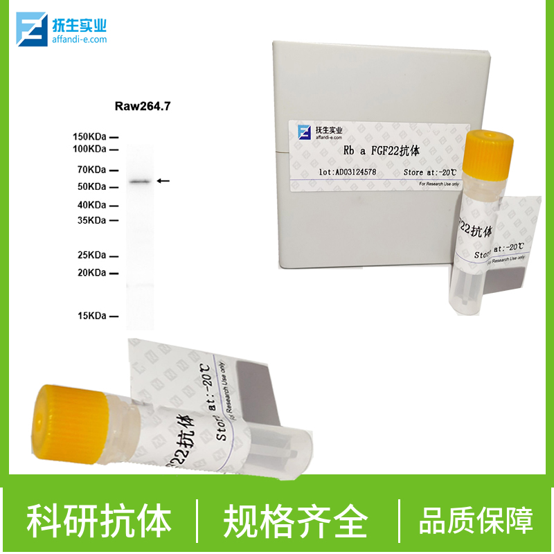 G蛋白偶联受体TAS1R3抗体