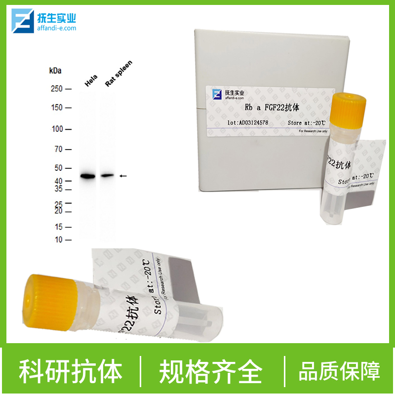 磷酸化β 连环素蛋白抗体