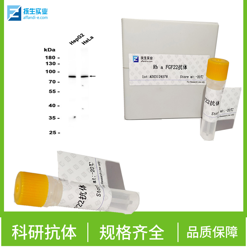 磷酸化蛋白激酶GCN2蛋白抗体