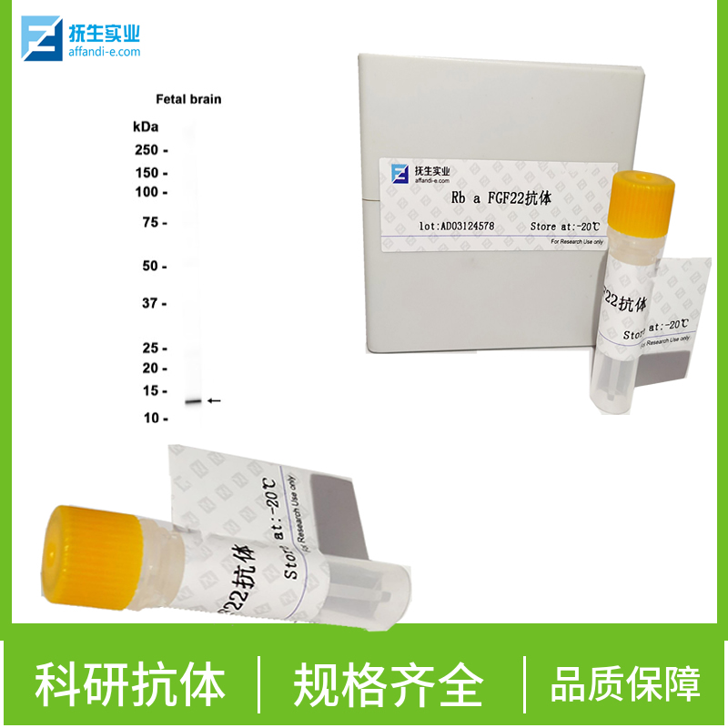 磷酸化蛋白激酶MST抗体