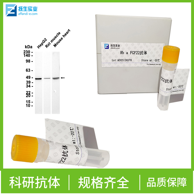 磷酸化蛋白质酪氨酸激酶JAK-1抗体