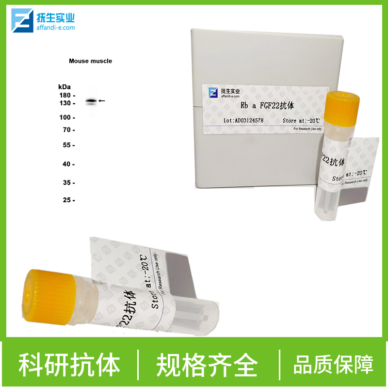 磷酸化过氧化酶活化增生受体γ抗体