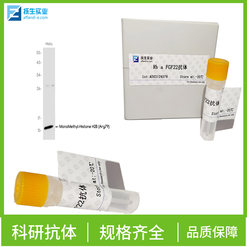 酪氨酸蛋白激酶受体B2抗体