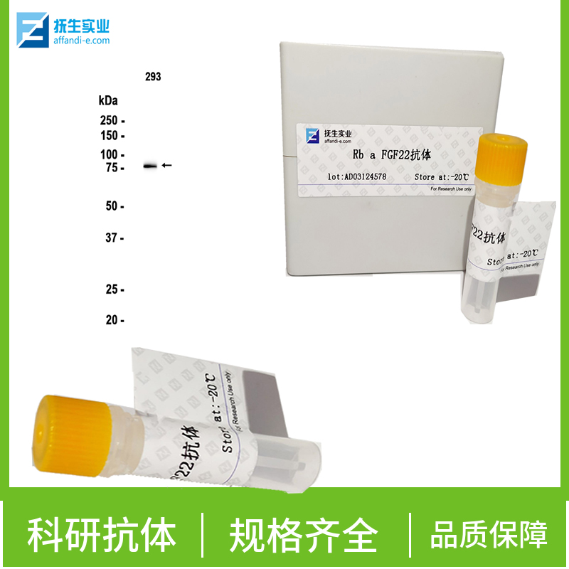 粒细胞-巨噬细胞集落刺激因子3抗体